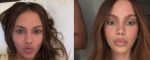 ANITTA GENERA DUDAS CON SU NUEVO ROSTRO: ¿SE HIZO MÁS CIRUGÍAS?